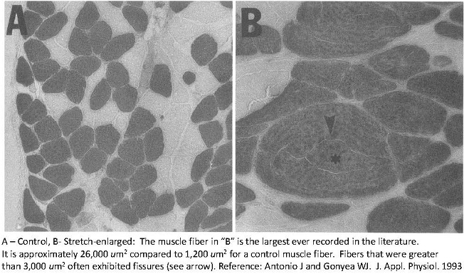 Muscle-fiber-hyperplasia-pic.jpg