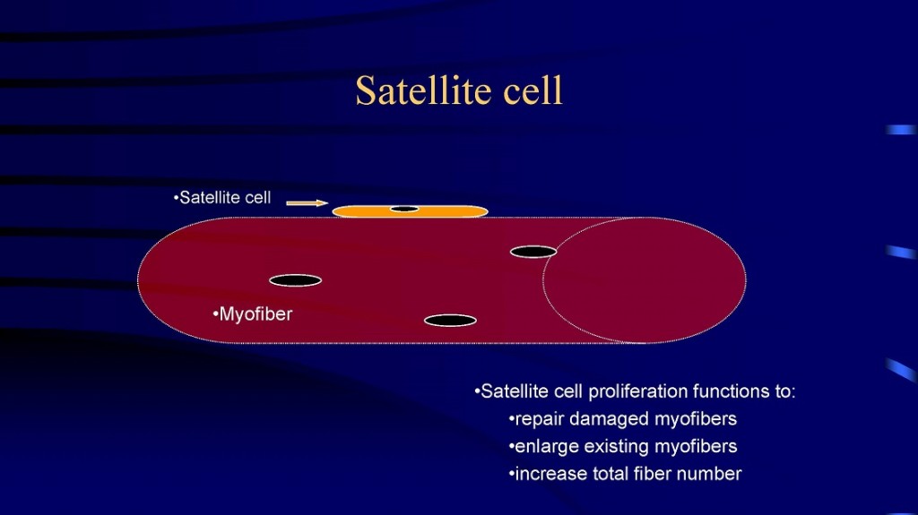 hyperplasia pics 2_Page_3