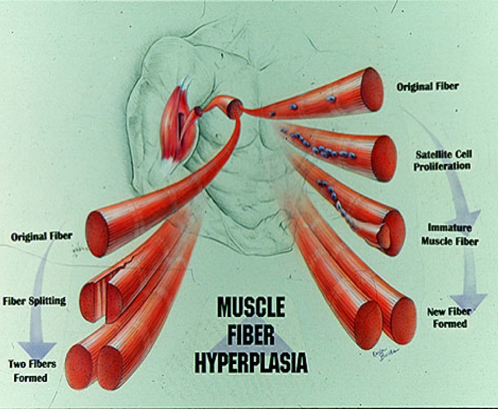 hyperplasia pics 2_Page_4