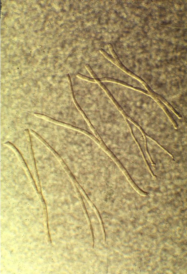 Check out these 'split' or branching fibers.  